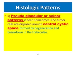 Histologic Patterns
• ii) Pseudo glandular or acinar
patterns is seen sometimes. The tumor
cells are disposed around central cystic
space formed by degeneration and
breakdown in the trabeculae.
HCC
 