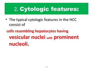 2. Cytologic features:
• The typical cytologic features in the HCC
consist of
cells resembling hepatocytes having
vesicular nuclei with prominent
nucleoli.
HCC
 