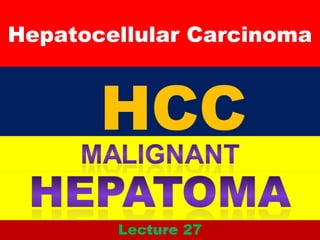 Hepatocellular Carcinoma
Lecture 27
HCC
Hepatoma
HCC,,,.2,28,28
 