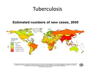 Tuberculosis
 