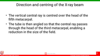 Positioning & tech Explain and Demonstrate The Radiographic positioning ...