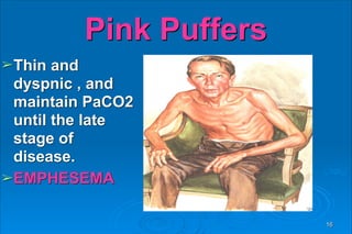 Pink Puffers
➢Thin and
dyspnic , and
maintain PaCO2
until the late
stage of
disease.
➢EMPHESEMA
16
 
