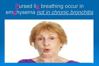 Pursed lip breathing occur in
emphysema not in chronic bronchitis
17
 
