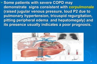 ➢Some patients with severe COPD may
demonstrate signs consistent with corpulmonale
(raised jugular venous pressure, loud P2 due to
pulmonary hypertension, tricuspid regurgitation,
pitting peripheral edema and hepatomegaly) and
its presence usually indicates a poor prognosis.
9
 