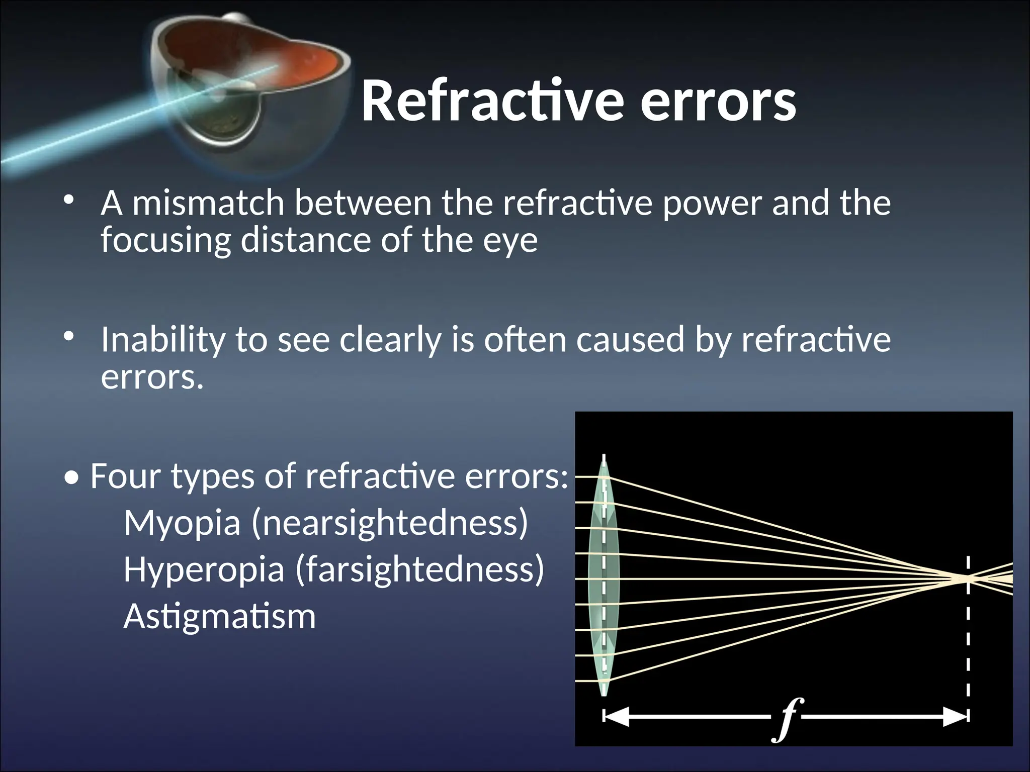 Refractive errors
• A mismatch between the refractive power and the
focusing distance of the eye
• Inability to see clearly is often caused by refractive
errors.
• Four types of refractive errors:
Myopia (nearsightedness)
Hyperopia (farsightedness)
Astigmatism
 