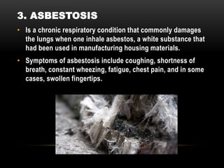 • Is a chronic respiratory condition that commonly damages
the lungs when one inhale asbestos, a white substance that
had been used in manufacturing housing materials.
• Symptoms of asbestosis include coughing, shortness of
breath, constant wheezing, fatigue, chest pain, and in some
cases, swollen fingertips.
3. ASBESTOSIS
 