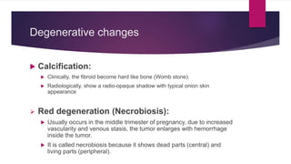 L48 Uterine Fibroids | PPTX | Pregnancy | Reproductive Health