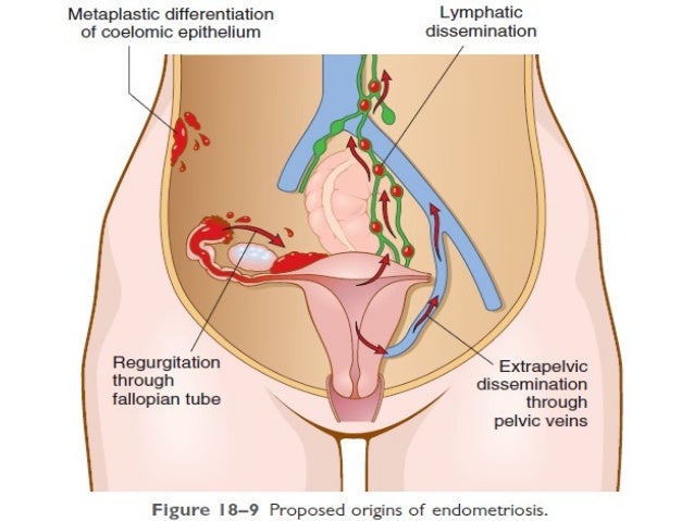 endometrium