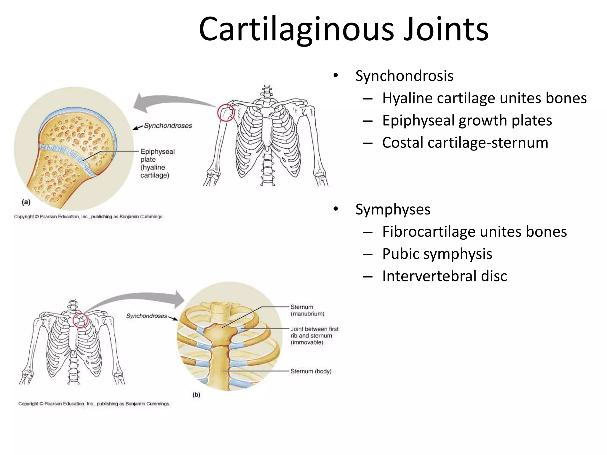 Cartilaginous JointsSynchondrosisHyaline cartilage unites bonesEpiphyseal growth platesCostal cartilage-sternumSymphysesFibrocartilage unites bonesPubic symphysisIntervertebral disc