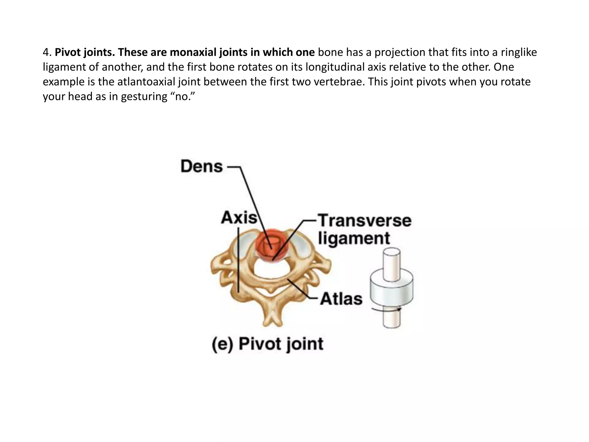 trochlear notch of ulna