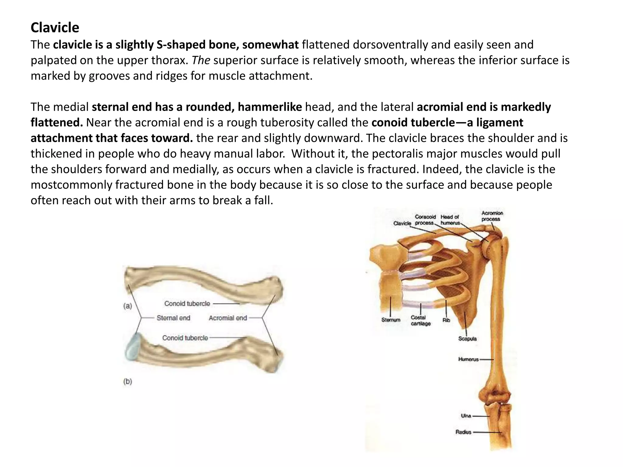 ClavicleThe clavicle is a slightly S-shaped bone, somewhat flattened dorsoventrally and easily seen and palpated on the upper thorax. The superior surface is relatively smooth, whereas the inferior surface is marked by grooves and ridges for muscle attachment.The medial sternal end has a rounded, hammerlikehead, and the lateral acromial end is markedly flattened. Near the acromial end is a rough tuberosity called the conoidtubercle—a ligament attachment that faces toward. the rear and slightly downward. The clavicle braces the shoulder and is thickened in people who do heavy manual labor.  Without it, the pectoralis major muscles would pull the shoulders forward and medially, as occurs when a clavicle is fractured. Indeed, the clavicle is the mostcommonlyfractured bone in the body because it is so close to the surface and because people often reach out with their arms to break a fall.