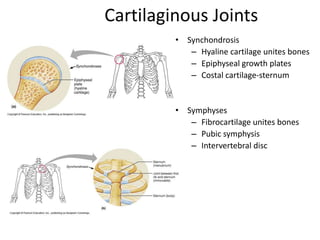 Cartilaginous JointsSynchondrosisHyaline cartilage unites bonesEpiphyseal growth platesCostal cartilage-sternumSymphysesFibrocartilage unites bonesPubic symphysisIntervertebral disc