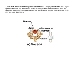 trochlear notch of ulna