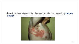 • Pain in a dermatomal distribution can also be caused by herpes
zoster
33
 