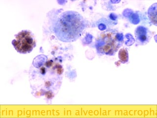erin pigments in alveolar macropha
 