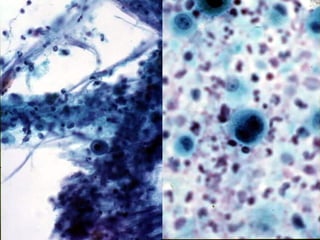 Respiratory Cytology
