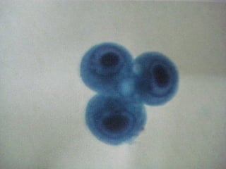 Respiratory Cytology