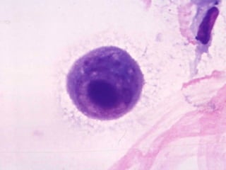 Respiratory Cytology