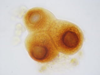 Respiratory Cytology