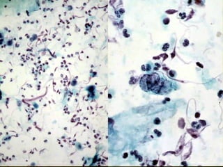 Respiratory Cytology