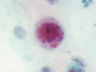 Respiratory Cytology