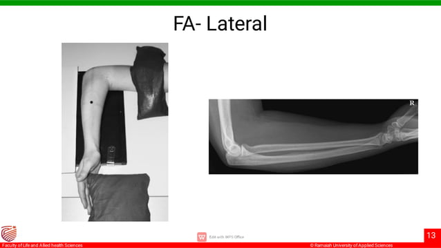 radiography of forearm from clarks positiong | PPT