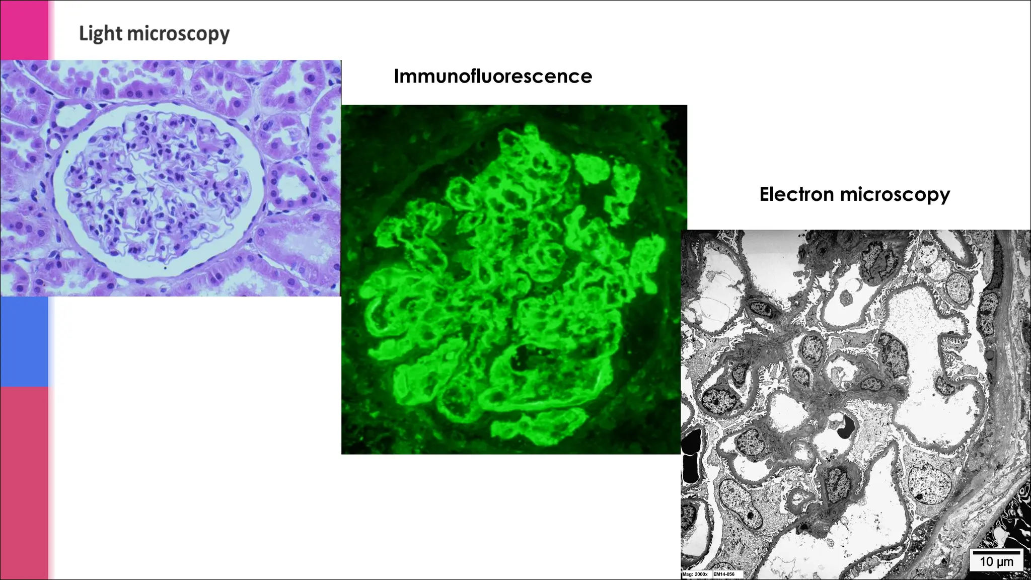Immunofluorescence
Electron microscopy
 