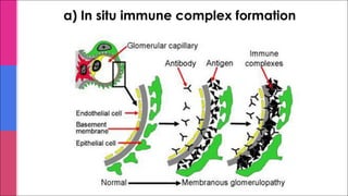 a) In situ immune complex formation
 