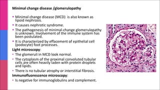 § Minimal change disease (MCD) is also known as
lipoid nephrosis.
§ It causes nephrotic syndrome.
§ The pathogenesis of minimal-change glomerulopathy
is unknown. Involvement of the immune system has
been postulated.
§ It is characterized by effacement of epithelial cell
(podocyte) foot processes.
Light microscopy:
• The glomeruli in MCD look normal.
• The cytoplasm of the proximal convoluted tubular
cells are often heavily laden with protein droplets
and lipids.
• There is no tubular atrophy or interstitial fibrosis.
Immunofluorescence microscopy:
• Is negative for immunoglobulins and complement.
Minimal change disease /glomerulopathy
 