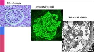 Immunofluorescence
Electron microscopy
 