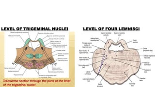 LEVEL OF TRIGEMINAL NUCLEI LEVEL OF FOUR LEMNISCI
 