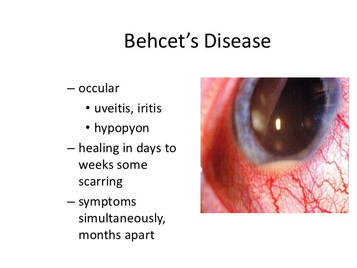 Dermatology 5th year, 5th lecture (Dr. Kazhan)
