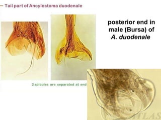 posterior end in
male (Bursa) of
A. duodenale
 