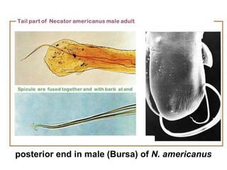 posterior end in male (Bursa) of N. americanus
 