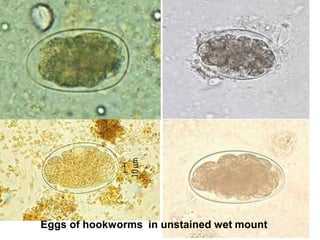 Eggs of hookworms in unstained wet mount
 