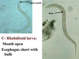 Open mouth
Bulb
C- Rhabditoid larva:
Mouth open
Esophagus short with
bulb
 