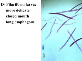 D- Filariform larva:
more delicate
closed mouth
long esophagous
 