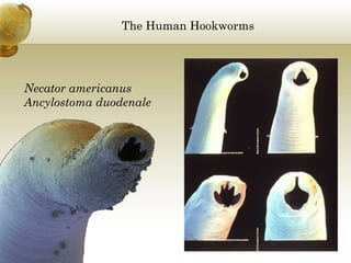 The Human Hookworms
Necator americanus
Ancylostoma duodenale
 