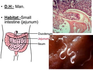 • D.H:- Man.
• Habitat:-Small
intestine (jejunum)
 