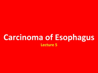 Carcinoma of Esophagus
Lecture 5
 