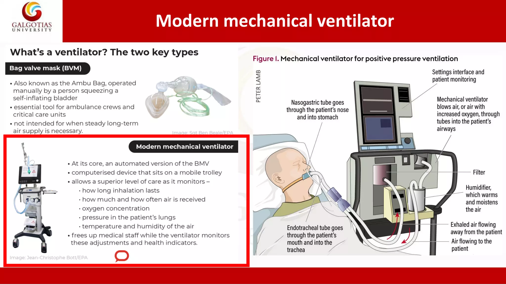 Modern mechanical ventilator
 