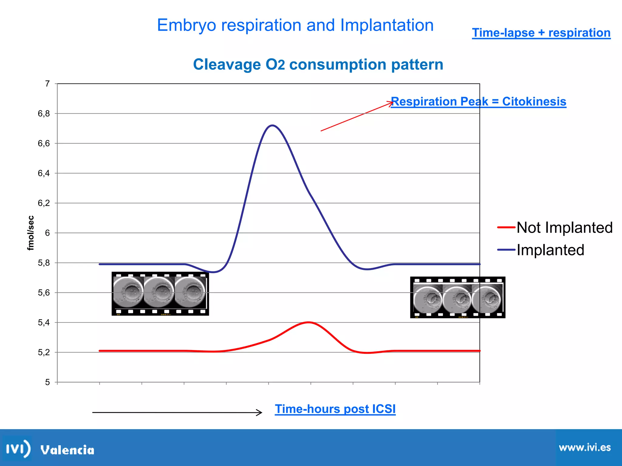 Time-lapse + respiration
Respiration Peak = Citokinesis
Time-hours post ICSI
Embryo respiration and Implantation
5
5,2
5,4
5,6
5,8
6
6,2
6,4
6,6
6,8
7
0 1 2 3 4 5 6 7 8 9 10
fmol/sec
Cleavage O2 consumption pattern
Not Implanted
Implanted
 