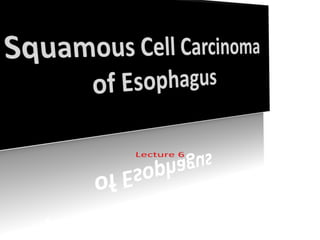 L6 squamous cell carcinoma of esophagus
