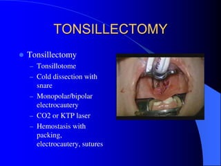 L6_TONSILLITIS.-ADENOIDS.-TONSILLAR-HYPERTROPHY-LECTURE.pdf