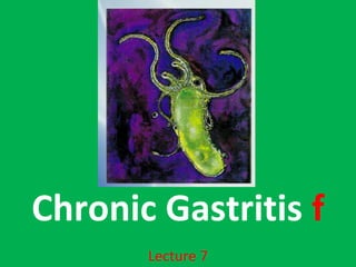 Chronic Gastritis f
Lecture 7
 