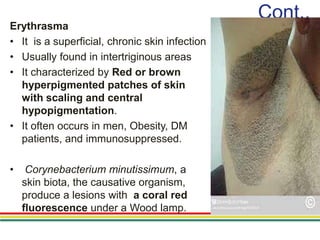 L8 Skin And Soft Tissue Infections pptx