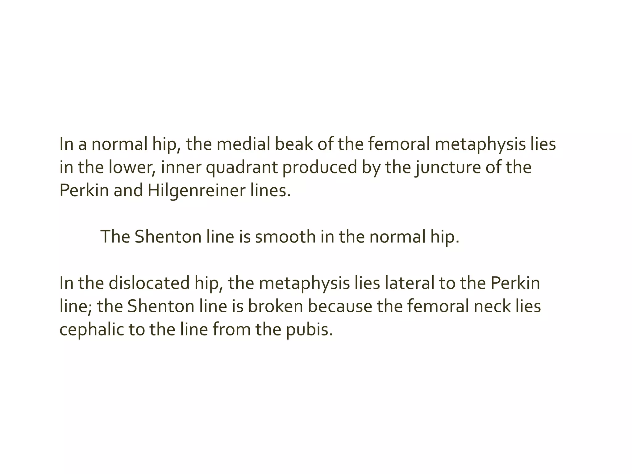 In a normal hip, the medial beak of the femoral metaphysis lies
in the lower, inner quadrant produced by the juncture of the
Perkin and Hilgenreiner lines.
The Shenton line is smooth in the normal hip.
In the dislocated hip, the metaphysis lies lateral to the Perkin
line; the Shenton line is broken because the femoral neck lies
cephalic to the line from the pubis.
 