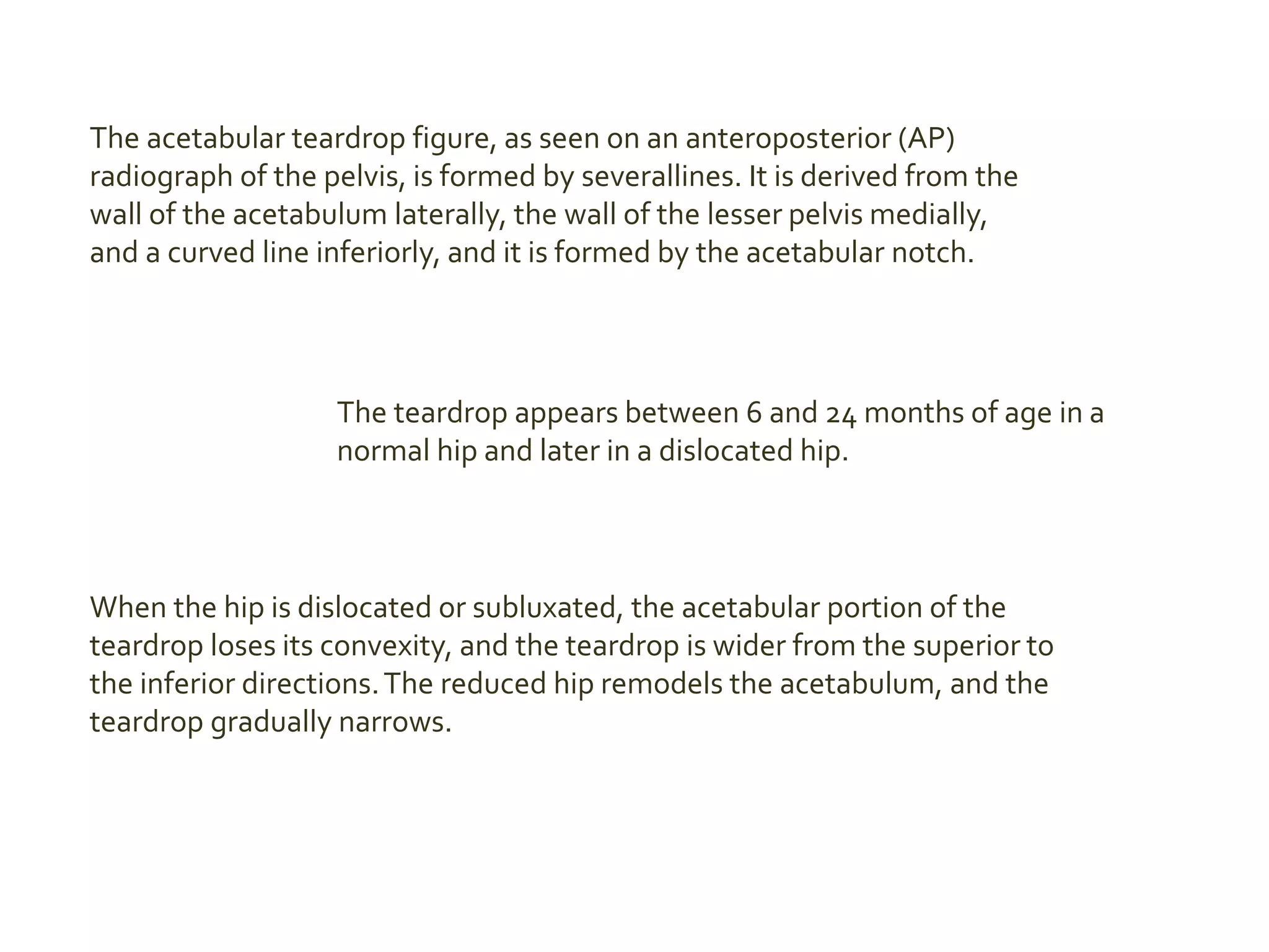 The acetabular teardrop figure, as seen on an anteroposterior (AP)
radiograph of the pelvis, is formed by severallines. It is derived from the
wall of the acetabulum laterally, the wall of the lesser pelvis medially,
and a curved line inferiorly, and it is formed by the acetabular notch.
The teardrop appears between 6 and 24 months of age in a
normal hip and later in a dislocated hip.
When the hip is dislocated or subluxated, the acetabular portion of the
teardrop loses its convexity, and the teardrop is wider from the superior to
the inferior directions.The reduced hip remodels the acetabulum, and the
teardrop gradually narrows.
 