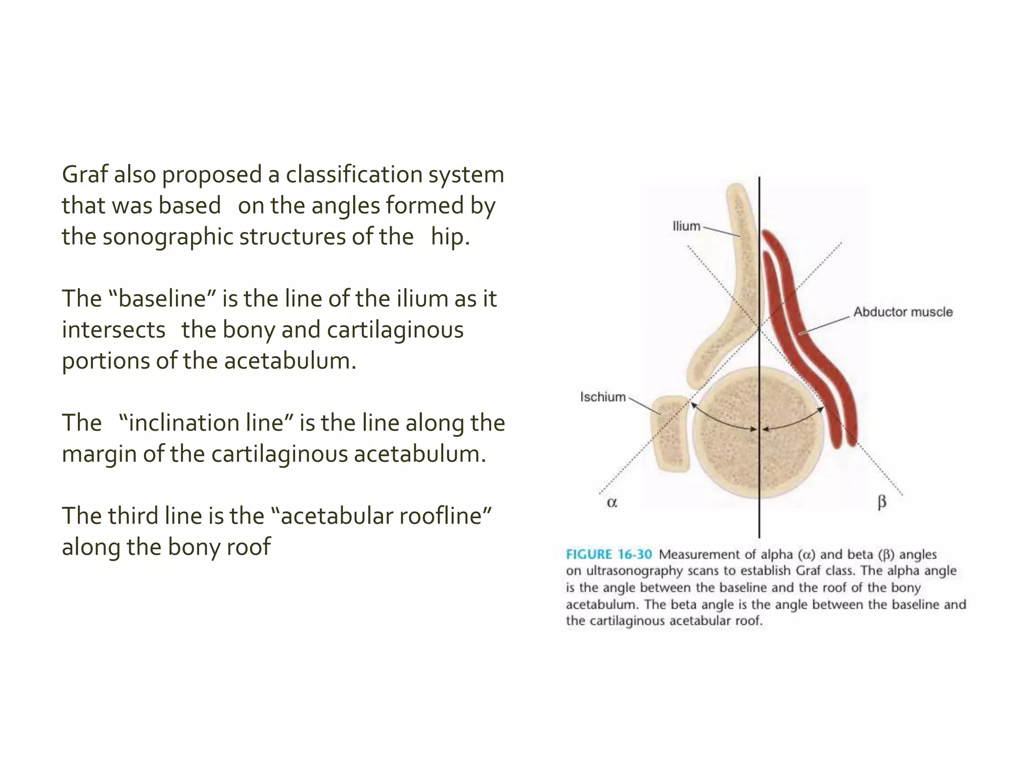 Graf also proposed a classification system
that was based on the angles formed by
the sonographic structures of the hip.
The “baseline” is the line of the ilium as it
intersects the bony and cartilaginous
portions of the acetabulum.
The “inclination line” is the line along the
margin of the cartilaginous acetabulum.
The third line is the “acetabular roofline”
along the bony roof
 