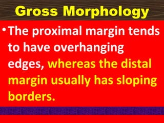 Gross Morphology
• The proximal margin tends
to have overhanging
edges, whereas the distal
margin usually has sloping
borders.

 